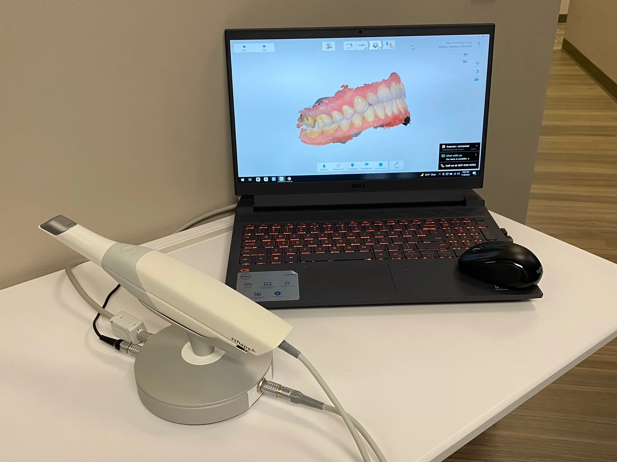 Escáner intraoral conectado a laptop mostrando el modelo 3D